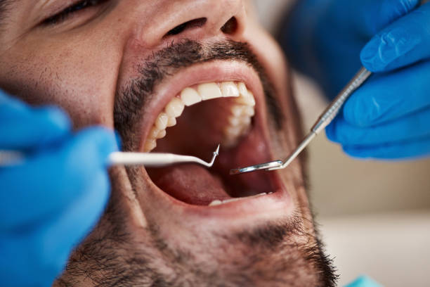 Best Emergency Dental Care for Trauma or Injury in Iowa Falls, IA